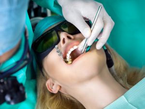 Carillas dentales. ¿Qué casos se pueden resolver?