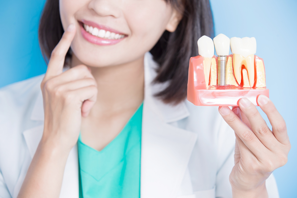 Mujer Dentista con ejemplo de implante dental y carillas